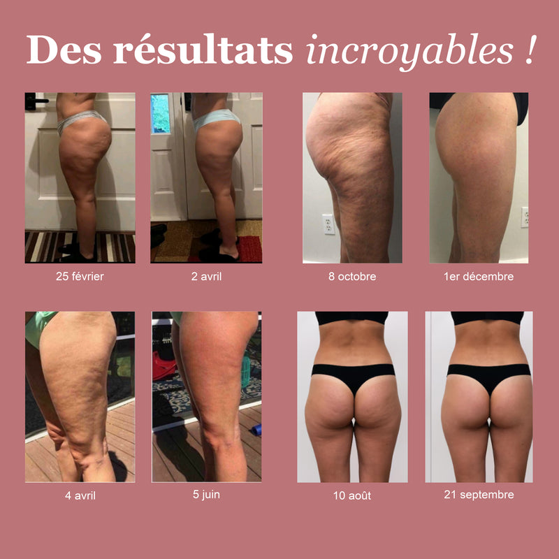 Résultat avant-après avec le legging rose LUMIVE